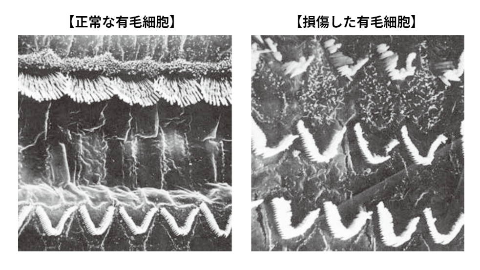 正常な有毛細胞と損傷した有毛細胞